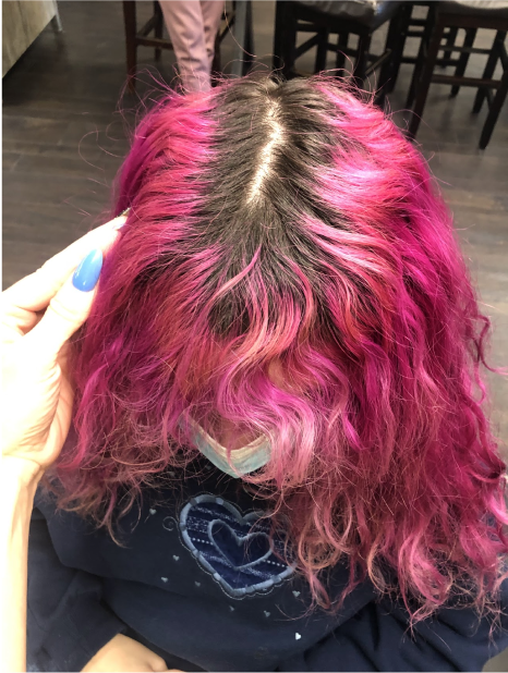 Before image: Color Correction + Bleaching