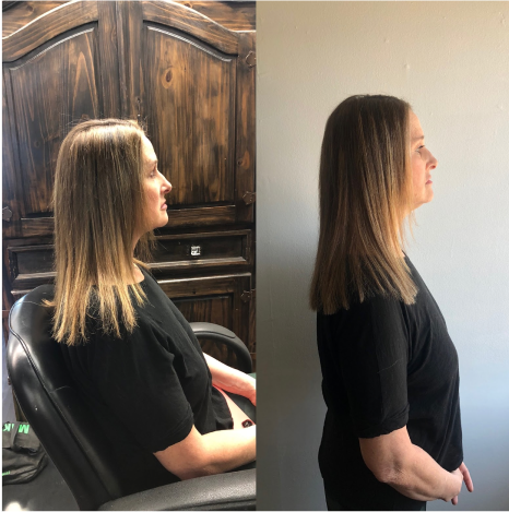 Before and After: Volumizing, Fill-in Extensions example (Side View)